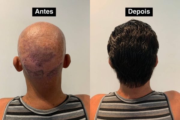 Antes e depois 2