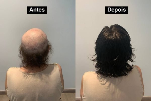 Antes e depois 3